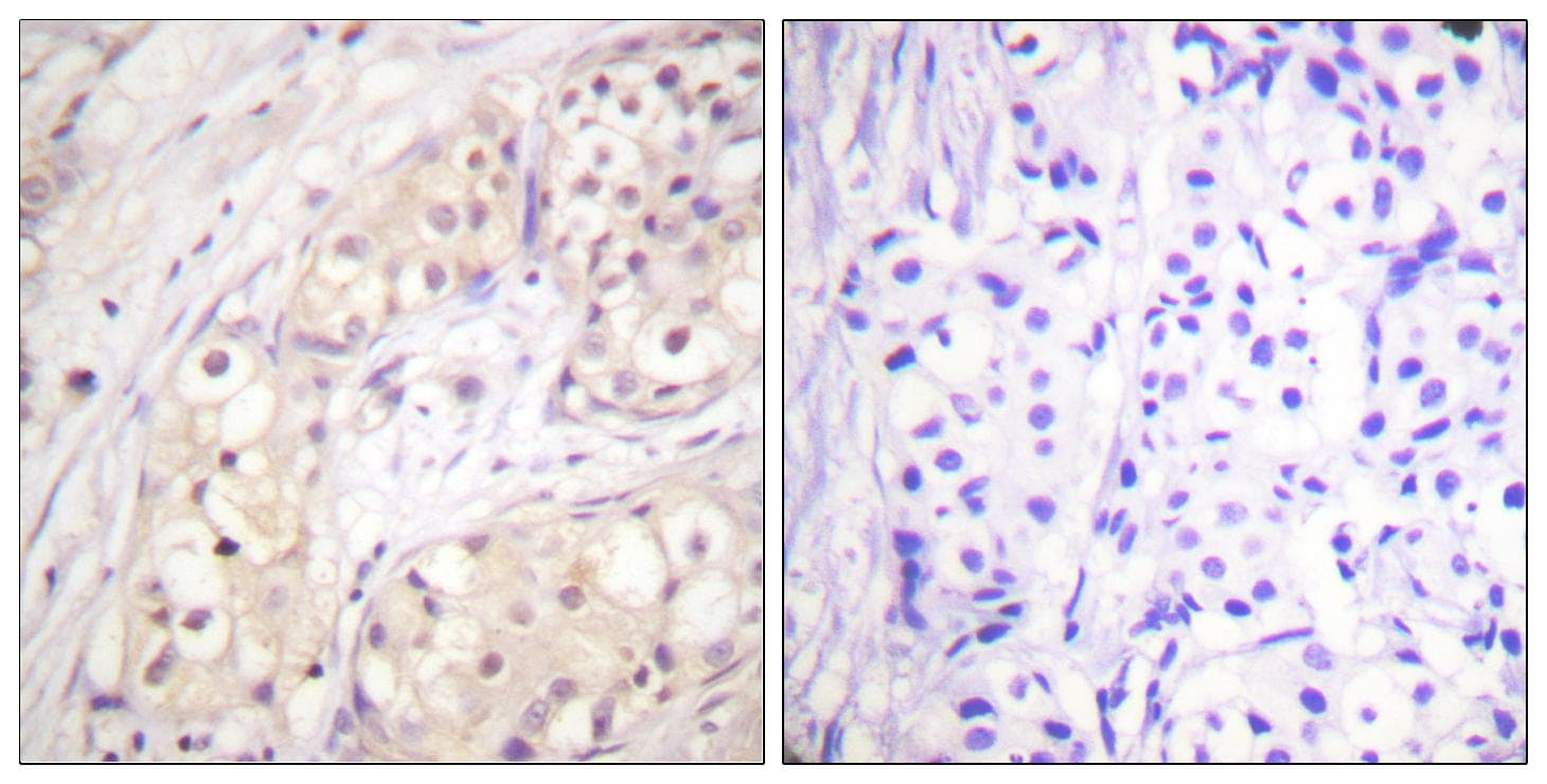 BRAF / B-Raf Antibody (Ab-598)
