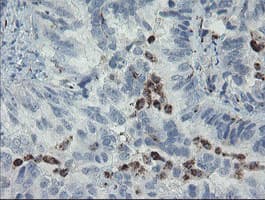 Monoclonal Mouse anti-Human MYL7 Antibody (clone OTI3A8, IHC, WB)