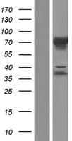 C1orf116 Protein (Over-Expression Lysate Myc-DDK (Flag))