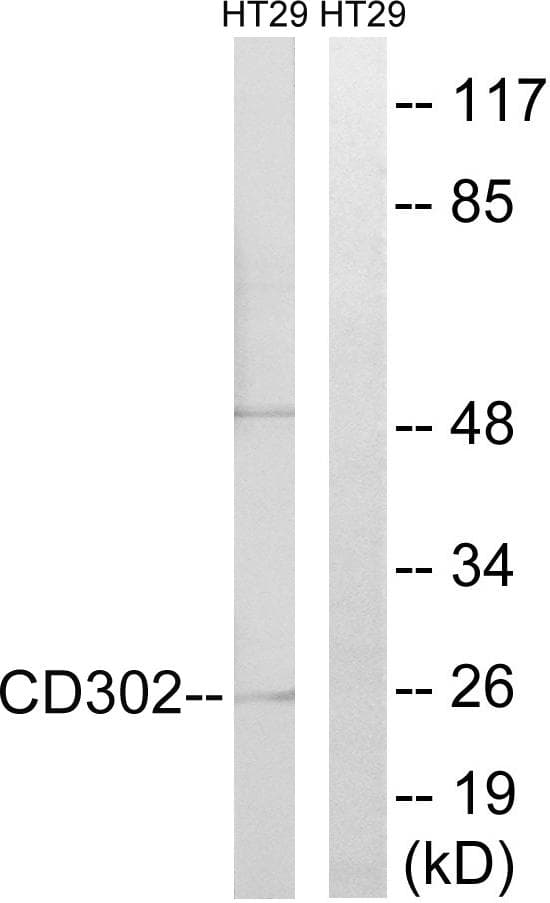 Polyclonal Rabbit anti-Human CD302 Antibody (IHC, WB)