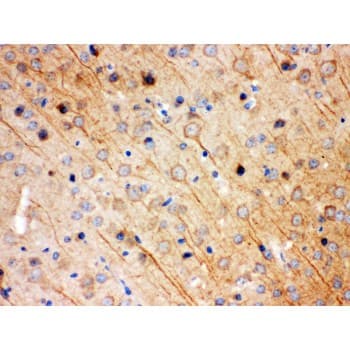 Polyclonal Rabbit anti-Human KCNIP2 / KCHIP2 Antibody (aa78-112, IHC, WB)