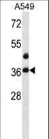 LASP1 Antibody (aa120-148)