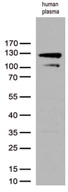 Complement C6 Antibody (aa176-522, clone OTI2G1, Carrier-free)