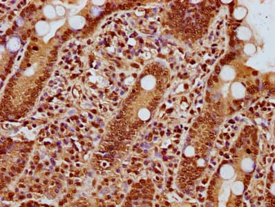 HIST1H3A Antibody