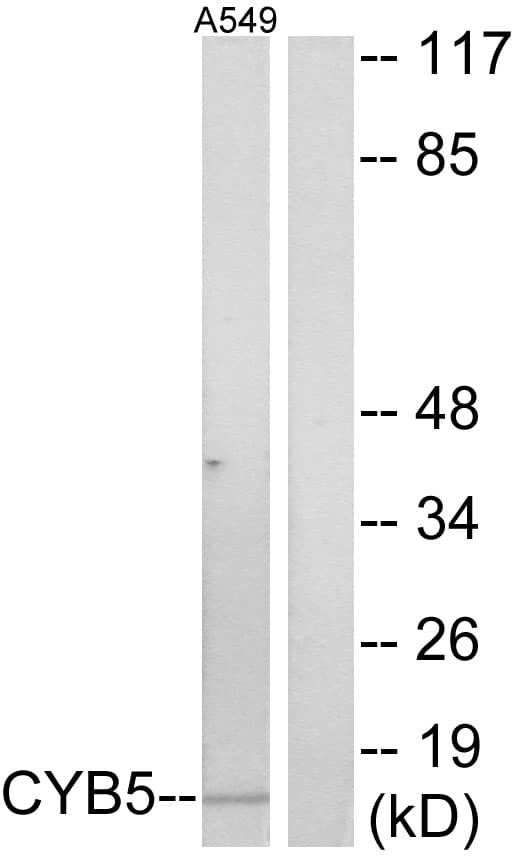 CYB5A / Cytochrome b5 Antibody (aa61-110)