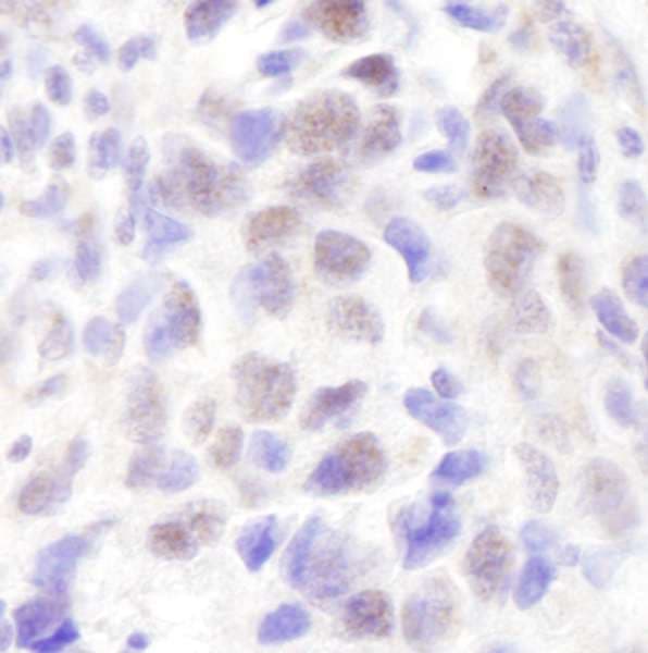 Polyclonal Rabbit anti-Human NCOA6 / ASC-2 Antibody (aa1050-1100, IHC, WB)
