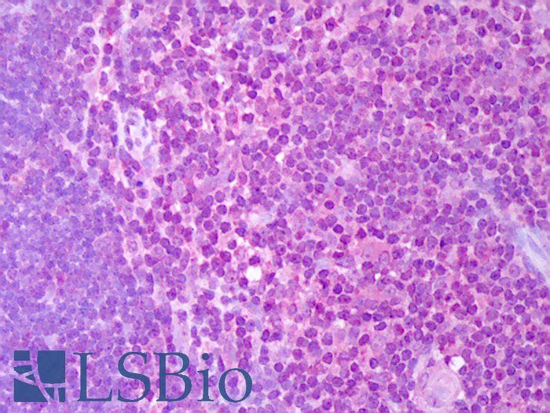 IHC-plus™ Polyclonal Goat anti-Human IL2 Antibody (IHC, WB)