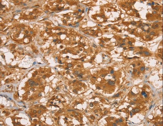 Polyclonal Rabbit anti-Human RBBP8 / CTIP Antibody (IHC)