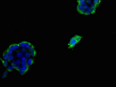 IHC-plus™ FDFT1 / Squalene Synthase Antibody (aa1-260)