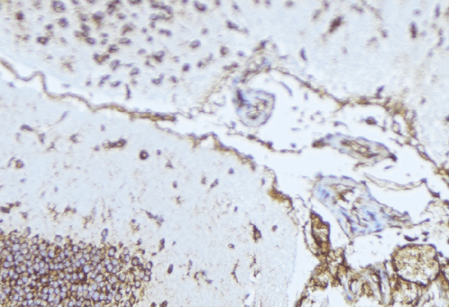 Polyclonal Rabbit anti-Human NDP Antibody (IHC, WB)