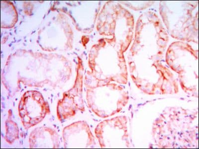 PTHR / PTHR1 Antibody (clone 4D2)