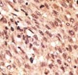 Polyclonal Rabbit anti-Human LRP5 Antibody (aa1538-1567, IHC, WB)