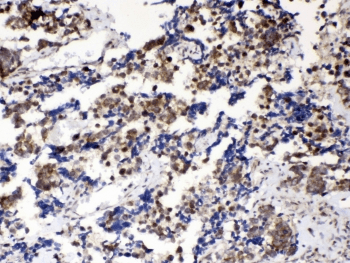 MSI1 / Musashi 1 Antibody
