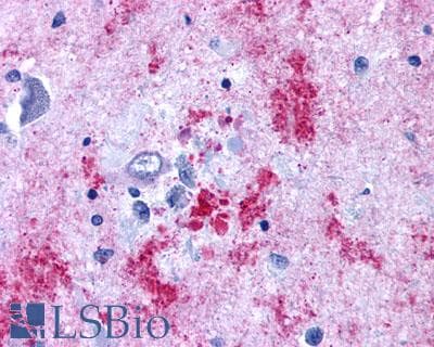 PathPlus™ EDNRB / Endothelin B Receptor Antibody (N-Terminus)
