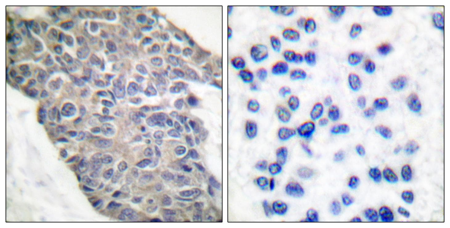 Polyclonal Rabbit anti-Human SYT1 / Synaptotagmin Antibody (p202, IHC, WB)