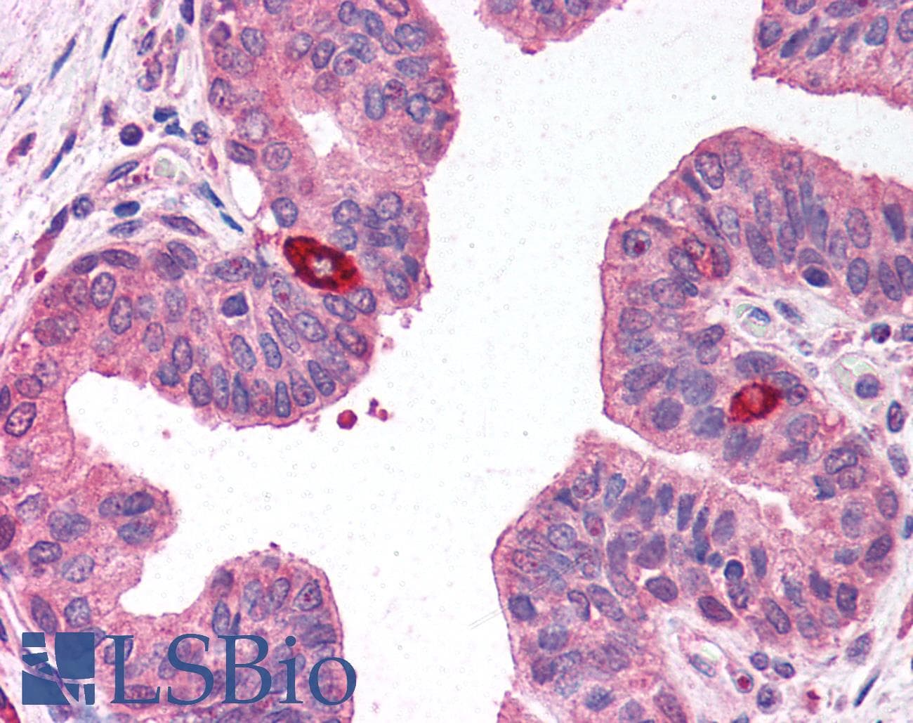 IHC-plus™ RNASEL / RNase L Antibody (clone 2E9)