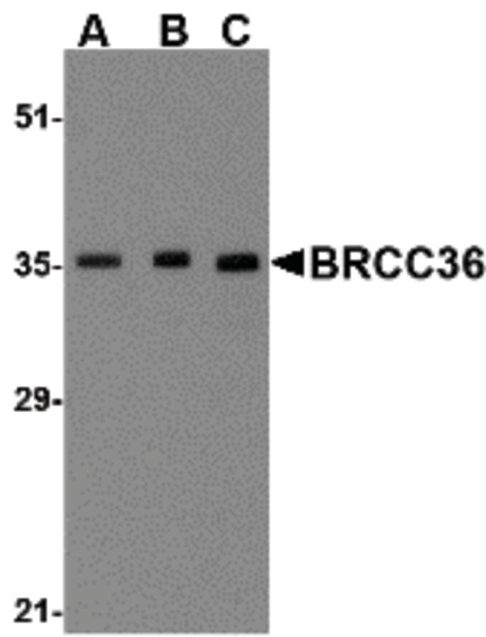 IHC-plus™ BRCC3 / BRCC36 Antibody