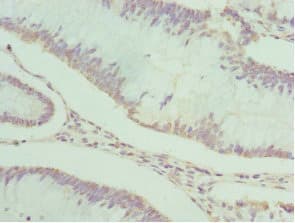 PDXK / PNK Antibody