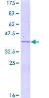 Human HYOU1 / ORP150 Protein (Recombinant GST)