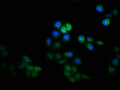 PathPlus™ KRT8 / CK8 / Cytokeratin 8 Antibody (aa2-483)