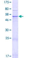 Human SRD5A2L / SRD5A3 Protein (Recombinant GST)