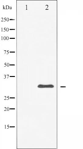 RPS6 / Ribosomal Protein S6 Antibody