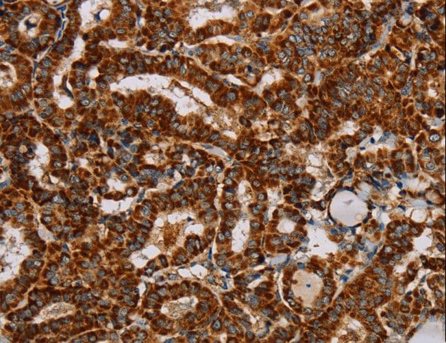 Polyclonal Rabbit anti-Human NDUFS3 Antibody (IHC, WB)