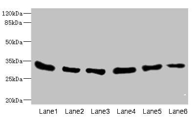 EIF2B1 Antibody