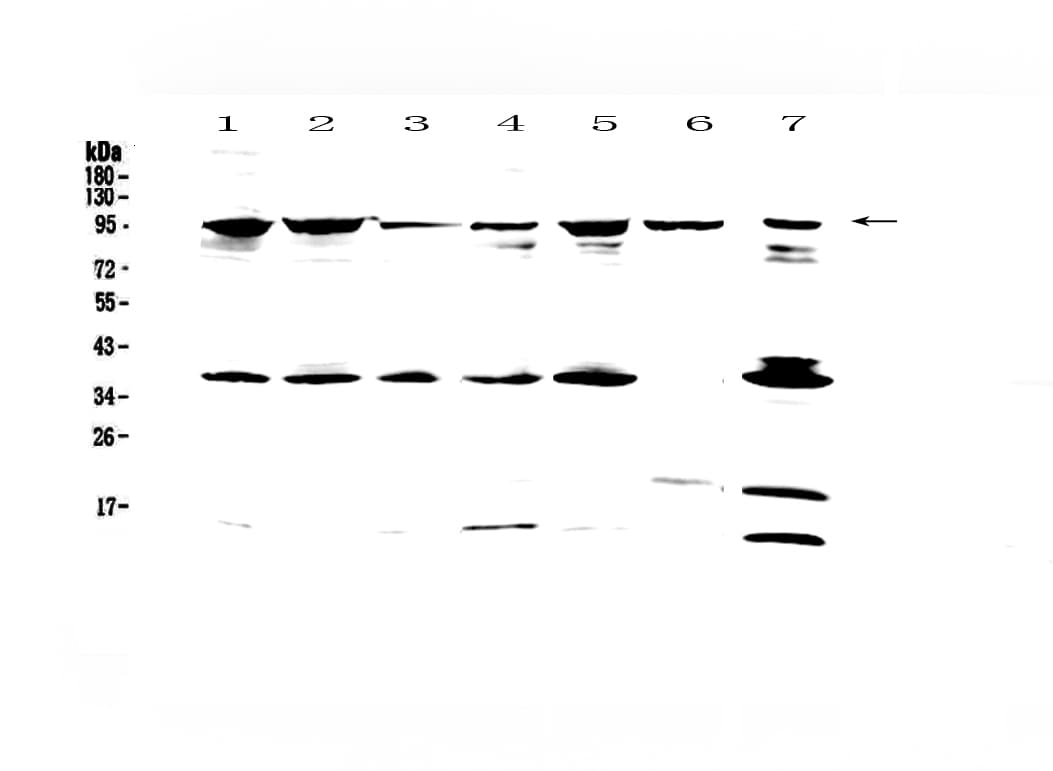 FES Antibody