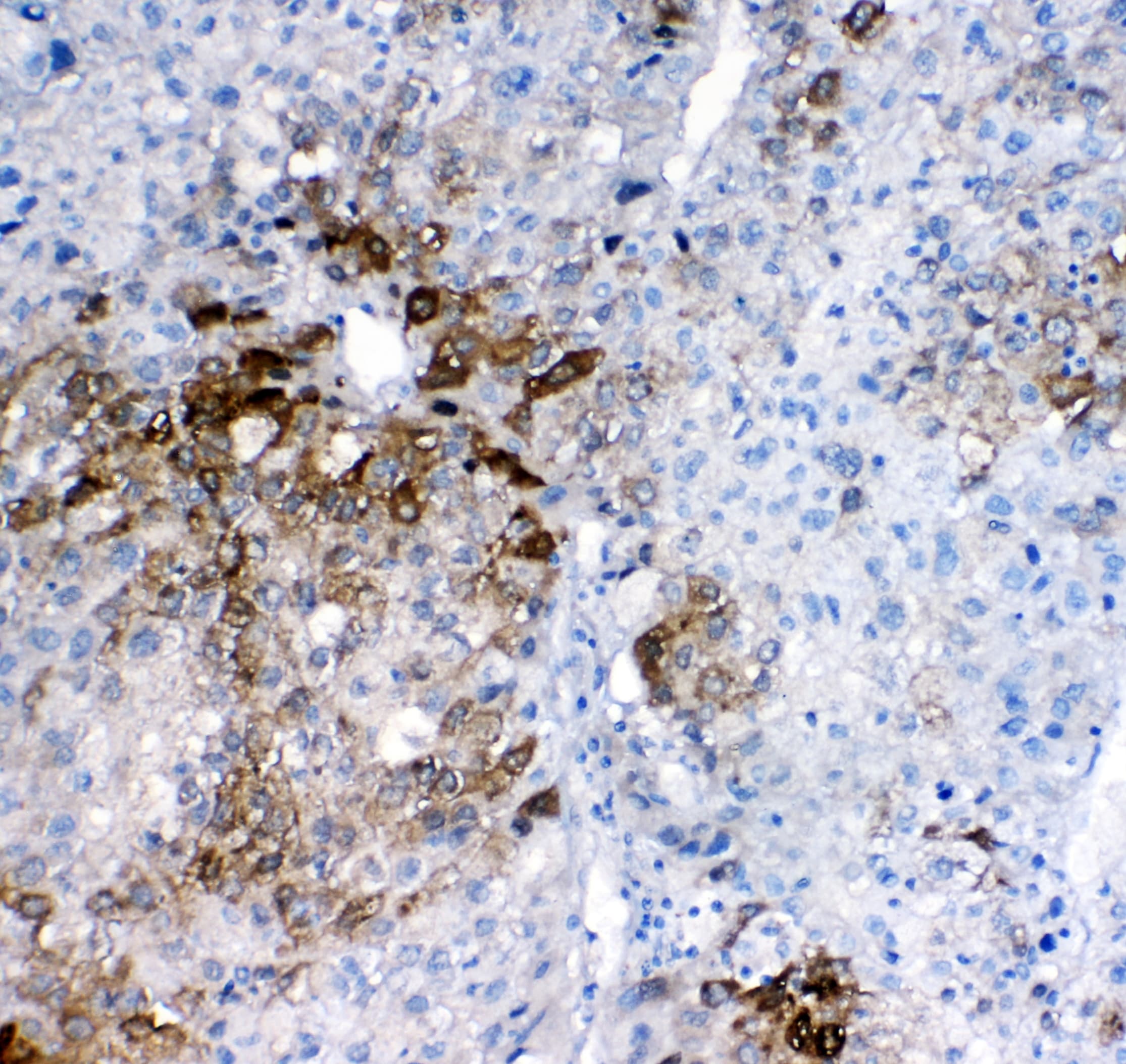 GSTA1+GSTA2+GSTA3+GSTA4+GSTA5 Antibody