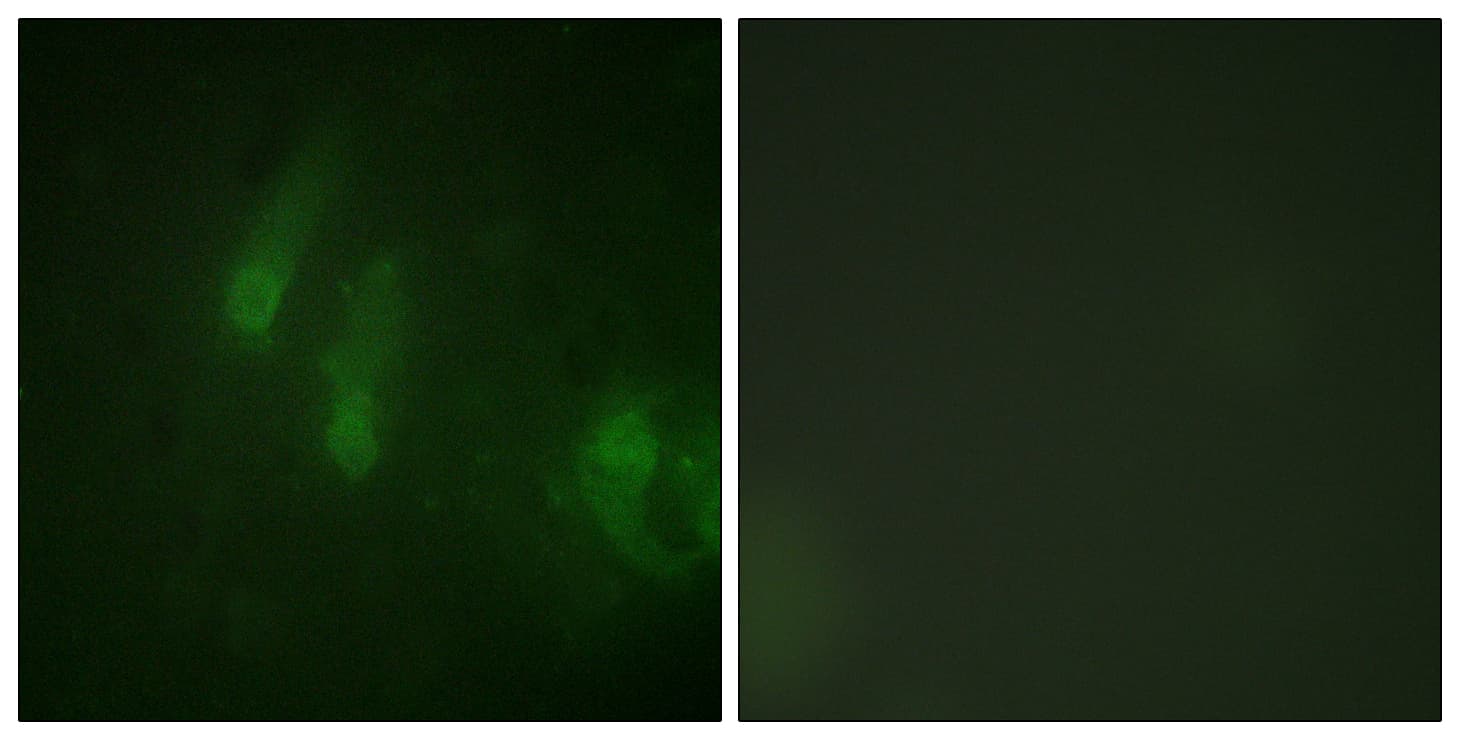 Polyclonal Rabbit anti-Human FANCA Antibody (phospho-Ser1149, IHC, IF, WB)