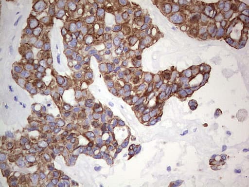 Monoclonal Mouse anti-Human KRT19 / CK19 / Cytokeratin 19 Antibody (clone OTI5F4, aa240-390, IHC, WB)