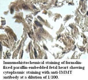 Polyclonal Rabbit anti-Human IMMT / Mitofilin Antibody (aa382-634, IHC, WB)