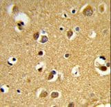 Polyclonal Rabbit anti-Human SNRPC / U1C Antibody (aa133-159, IHC, WB)