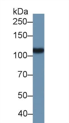 FOLH1 / PSMA Antibody (aa275-588, Biotin)