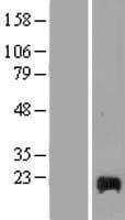 CTSC / Cathepsin C / JP Protein (Over-Expression Lysate Myc-DDK (Flag))