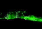 Polyclonal Rabbit anti-Human BAG3 / BAG-3 Antibody (C-Terminus, IHC, WB)