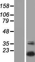 UBTD2 Protein (Over-Expression Lysate Myc-DDK (Flag))