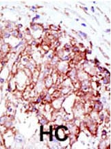 MIB1 Antibody (aa13-42)