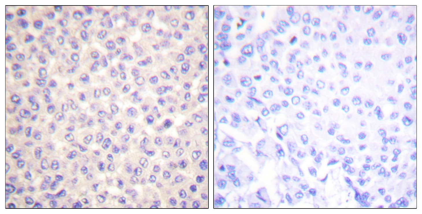 FADD Antibody (phospho-Ser194)