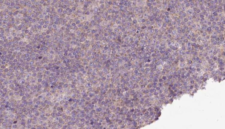 PMPCB / MPP11 Antibody