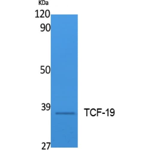 TCF19 / TCF-19 Antibody (Internal)