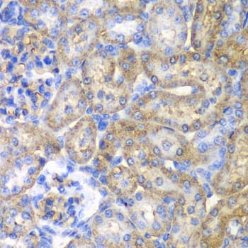 EHHADH / Enoyl-Coa Hydratase Antibody