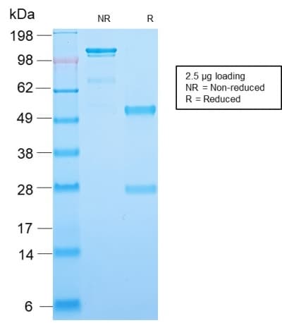 SCGB2A2 / Mammaglobin A Antibody (clone MGB1/2123R)