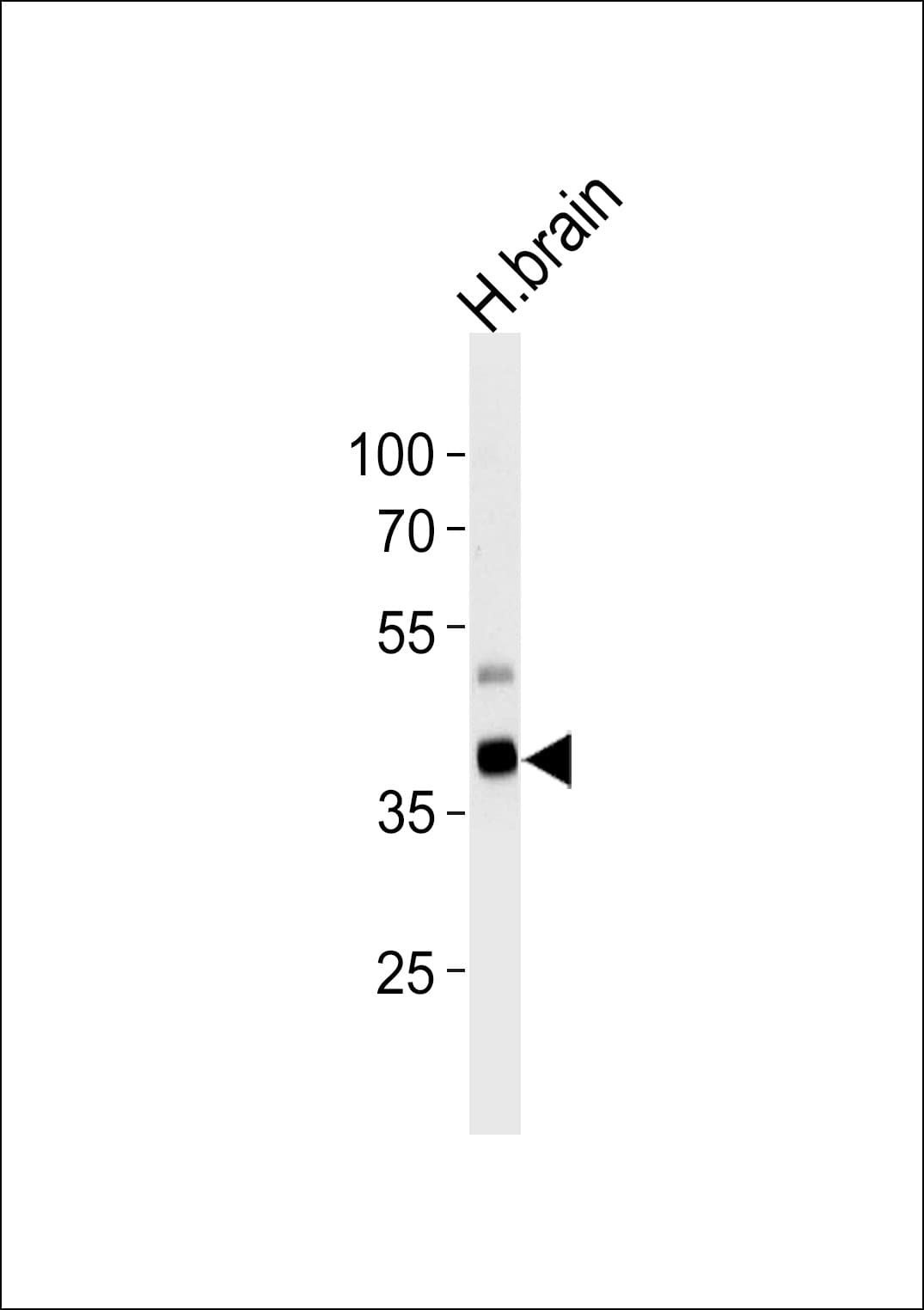 PIP4K2C Antibody (aa333-364)