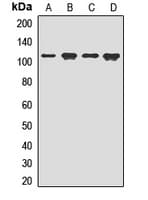DDR2 Antibody