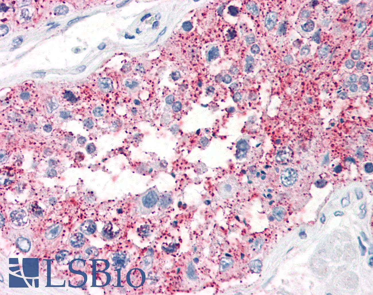 IHC-plus™ SRPX2 Antibody (C-Terminus)