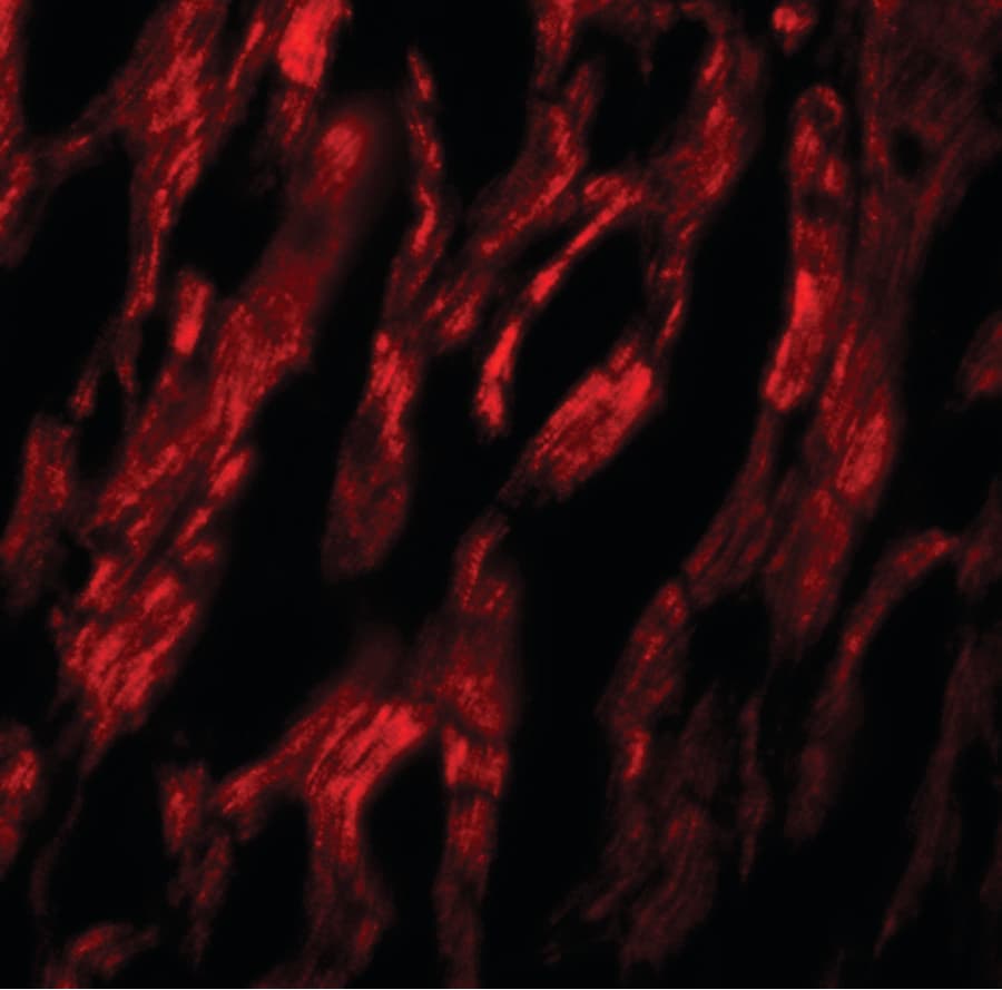 IHC-plus™ Polyclonal Rabbit anti-Human ATG9A Antibody (IHC, IF, WB)