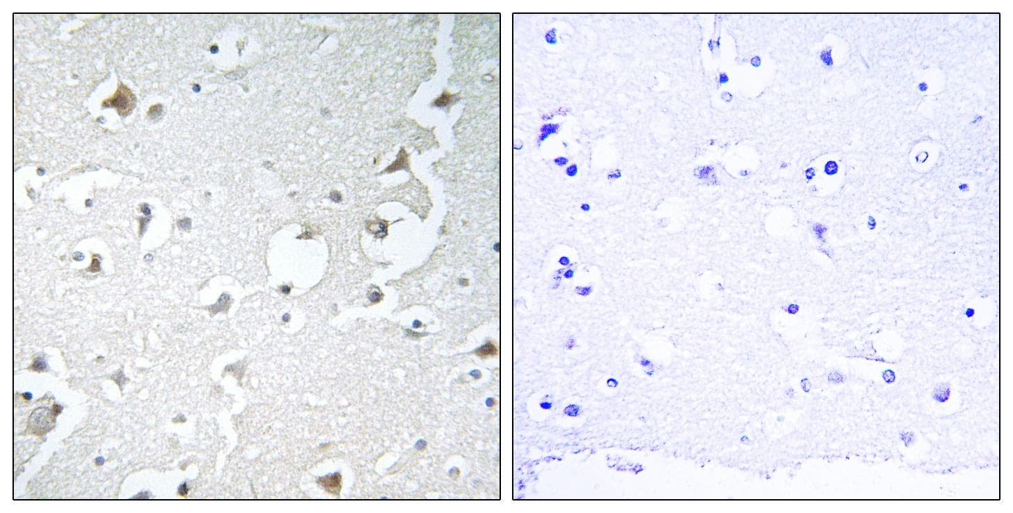 Polyclonal Rabbit anti-Human MAPK8IP1 / JIP1 Antibody (p103, IHC, IF, WB)
