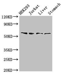 Polyclonal Rabbit anti-Human TXK / RLK Antibody (IHC, IF, WB)